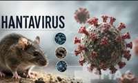 نشست علمی HANTAVIRUS  (هانتا ویروس) در مرکز پزشکی ، آموزشی و درمانی لقمان حکیم 